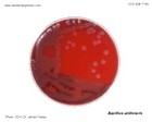 b.anthracis on petri dish